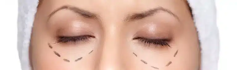 Ästhetisch Operative Dermatologie Berlin
