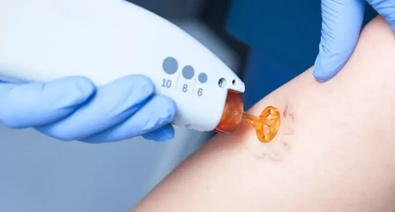 Laserchirurgie Hautarzt Berlin
